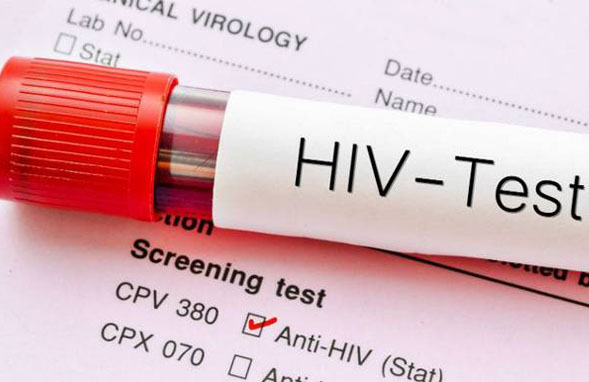 London Patient is now the second adult to be “functionally cured” of the HIV infection